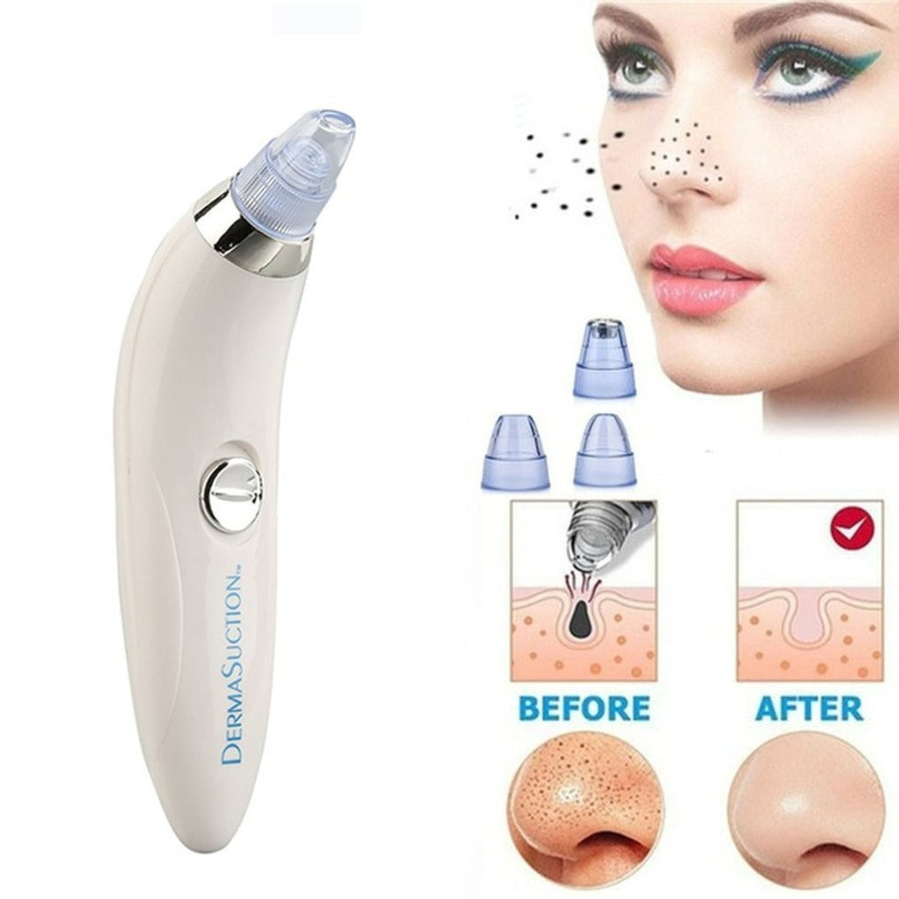 4 in 1 Derma Suction Device